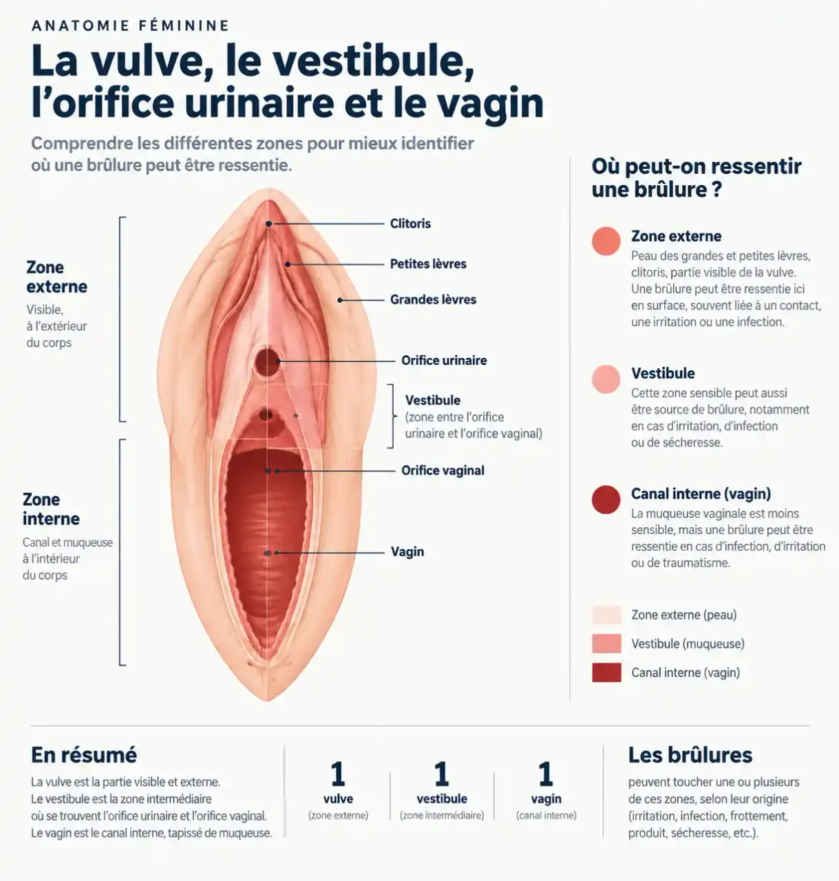 Schéma anatomique pour comprendre les brûlures vulvaires sans infection et localiser la vulve, le vestibule et le vagin